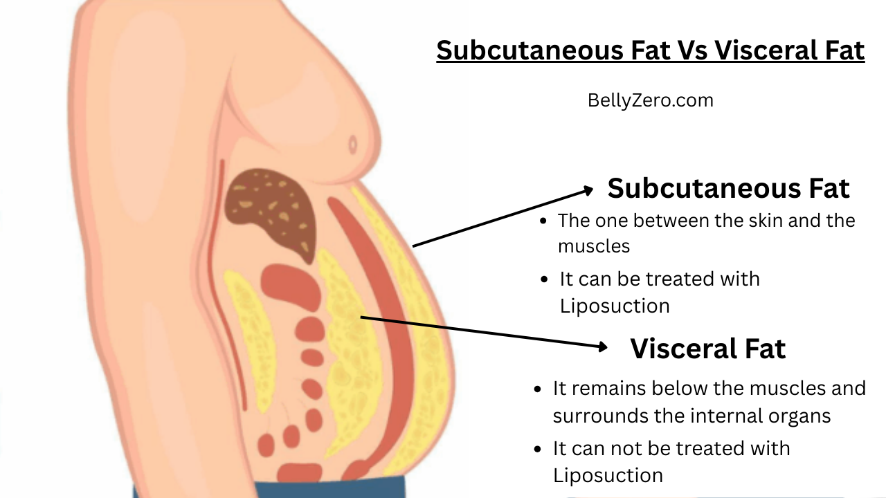Medical diagram showing the difference between visceral fat surrounding internal organs and subcutaneous fat located directly under the skin in a cross-section of the human abdomen